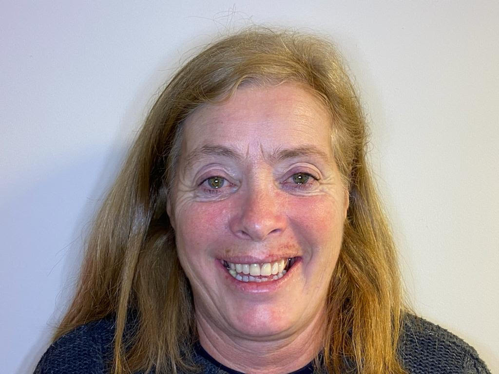 Allon4 dental implants in West Bridgford Replace a full set of